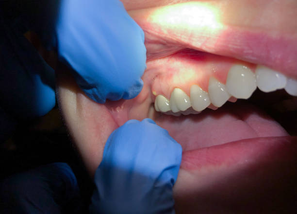 Best Urgent Dental Care for Toothaches in Harbison Nyon, CA