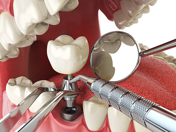 Professional Emergency Dental Service in CA
