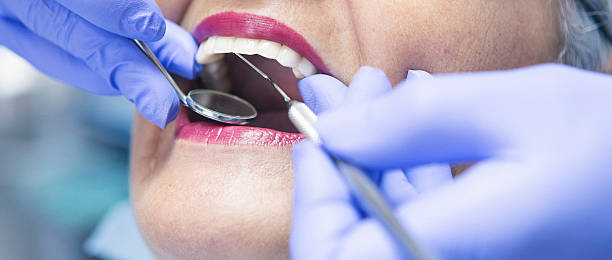 Best Emergency Cosmetic Dentistry (e.g., broken veneers) in Harbison Nyon, CA